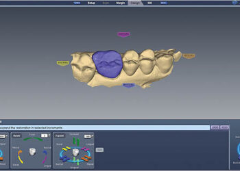 Dental treatment improvements thanks to 3D scanning and printing