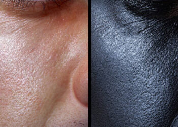 Texturing.xyz offers detailed skin displacement maps
